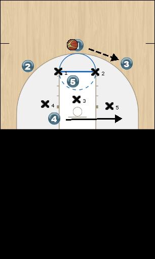 Basketball Play High Low Zone Play 