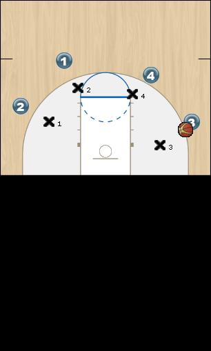 Basketball Play If Merlin doesn’t play Defense