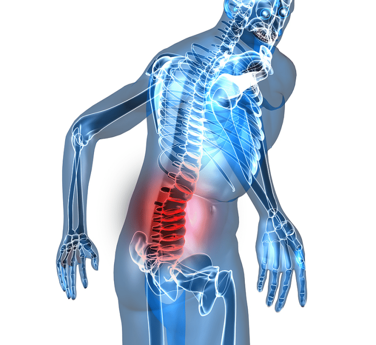 back pain