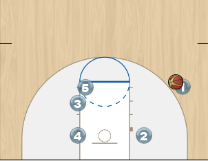 Man Set with 2 Stagger Screens